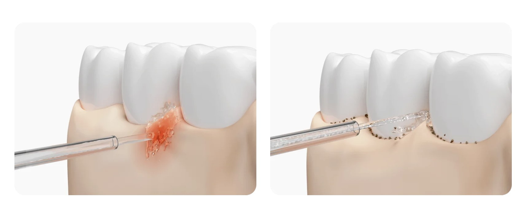 Фото 2 Water Flosser 2