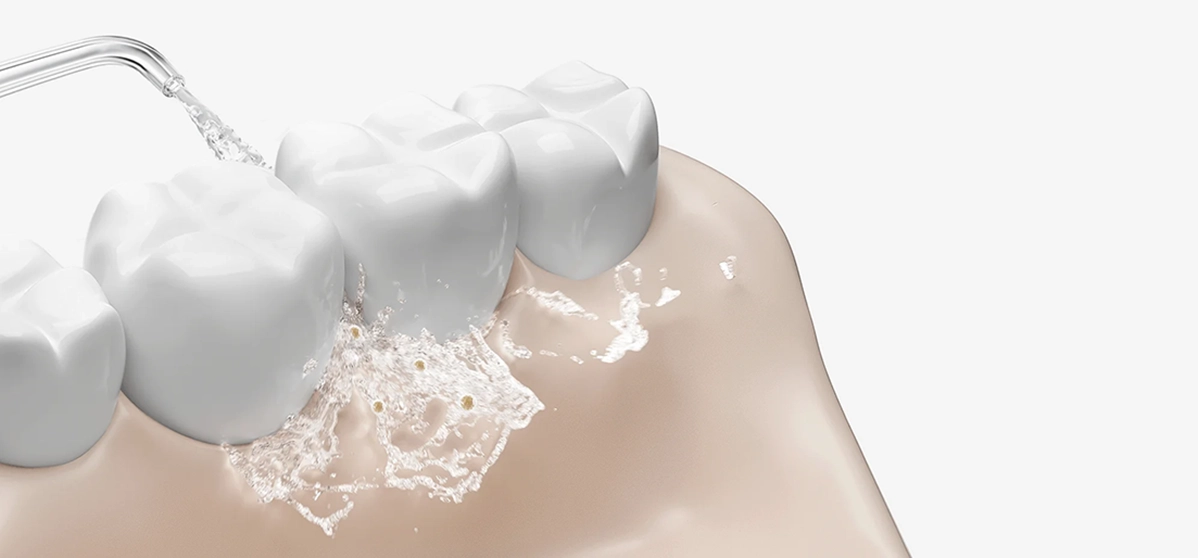 Фото 3 Water Flosser 2