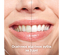 Купить - зубную щетку  Звуковая электрическая зубная щетка PHILIPS DiamondClean 9000 HX9911/27