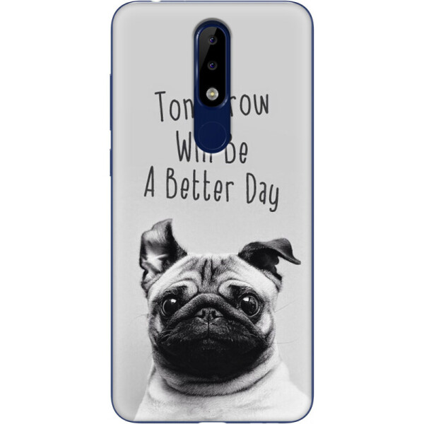 

Силиконовый чехол BoxFace Nokia 5.1 Plus (36117-up726)