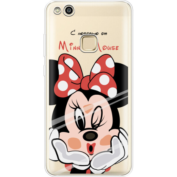 

Силиконовый чехол BoxFace Huawei P10 Lite Lady M (29363-cc59)