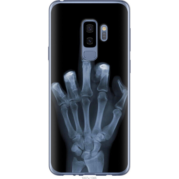

на Samsung Galaxy S9 Plus Рука через рентген