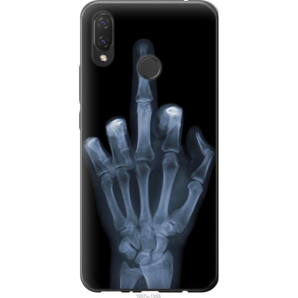 

Чехол на Huawei P Smart Plus Рука через рентген