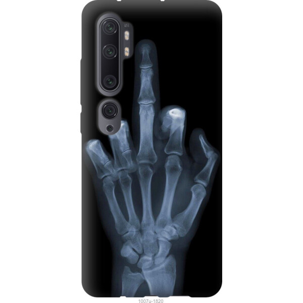 

Чехол на Xiaomi Mi Note 10 Рука через рентген