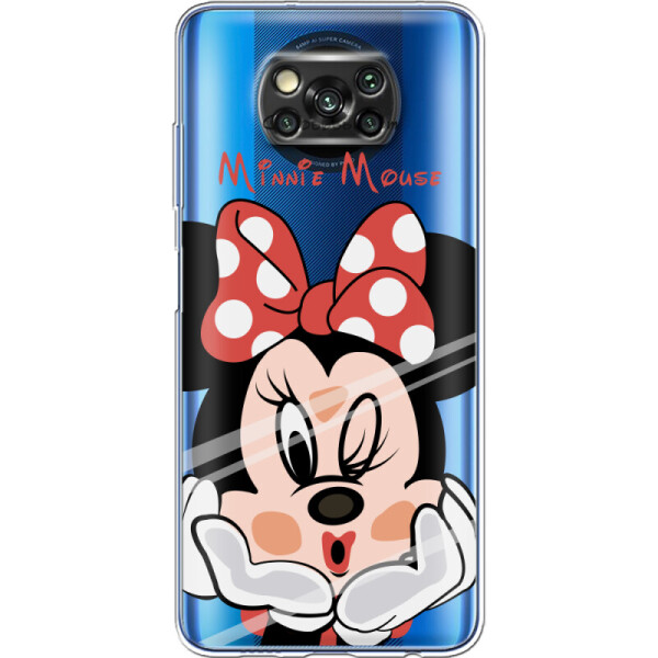 

Силиконовый чехол BoxFace Xiaomi Poco X3 Lady M (41288-cc59)