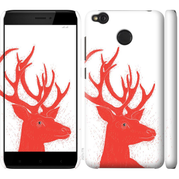 

Чехол на Xiaomi Redmi 4X Oh My Deer (04798)