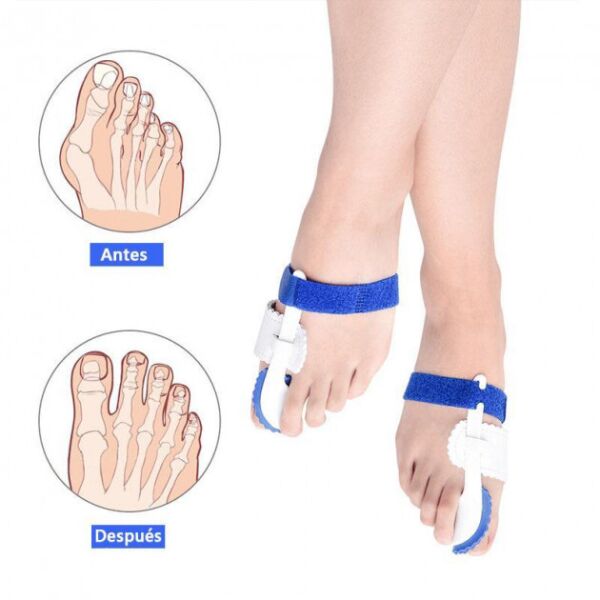 

Фиксатор на палец Profoot Синий (HbP050614)