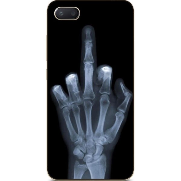 

Силиконовый чехол Candy для Iphone 8 plus с рисунком Рентген