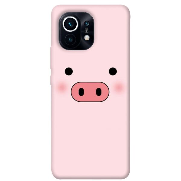 

Чехол itsPrint Мордочка поросенка для Xiaomi Mi 11