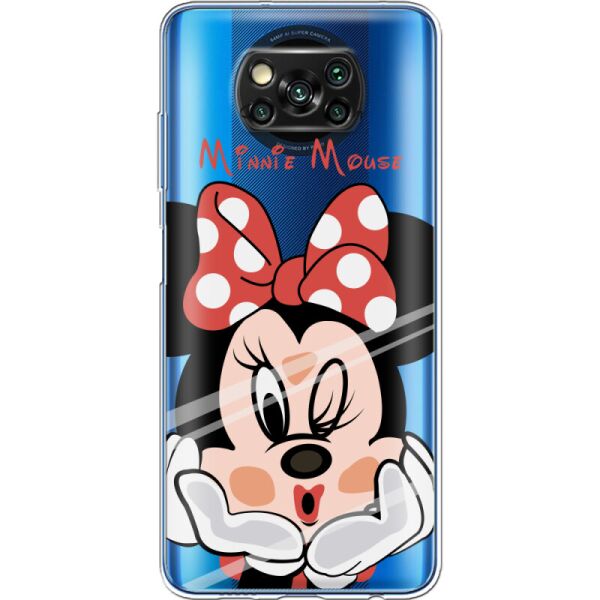 

Силиконовый чехол BoxFace Xiaomi Poco X3 Pro Lady M (42093-cc59)