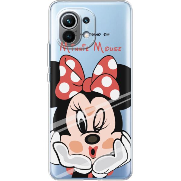 

Силиконовый чехол BoxFace Xiaomi Mi 11 Lady M (41924-cc59)
