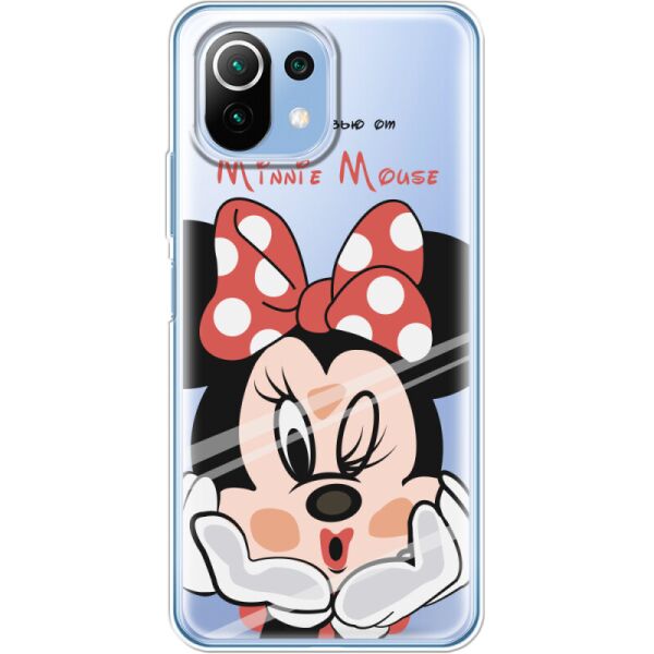 

Силиконовый чехол BoxFace Xiaomi Mi 11 Lite Lady M (42128-cc59)