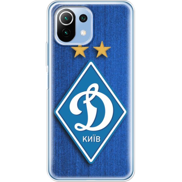 

Силиконовый чехол BoxFace Xiaomi Mi 11 Lite Динамо Киев (42128-up274)