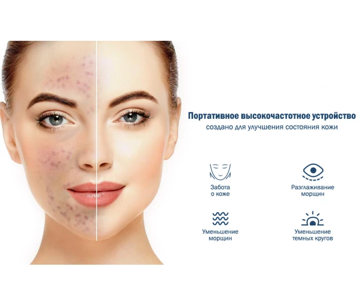 Фото - ультразвуковой скрабер Скрабер ультразвуковой для лица кожи Medica+ Vibroskin 8.0 (Япония) (50124)