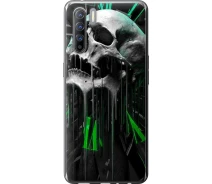 Купить - чехол для смартфона  Чехол силиконовый на телефон Oppo Reno 3 Череп-часы "4100u-1901-1529"